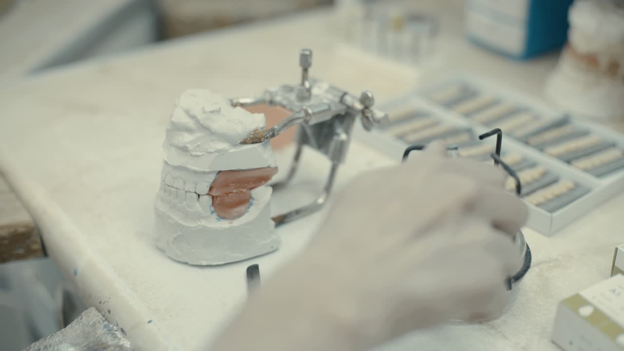 el proceso de creación de una corona y un yeso