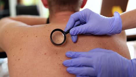 dermatologist examining moles on a patient's back with a magnifying glass
