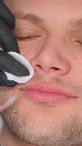 lip injection procedure