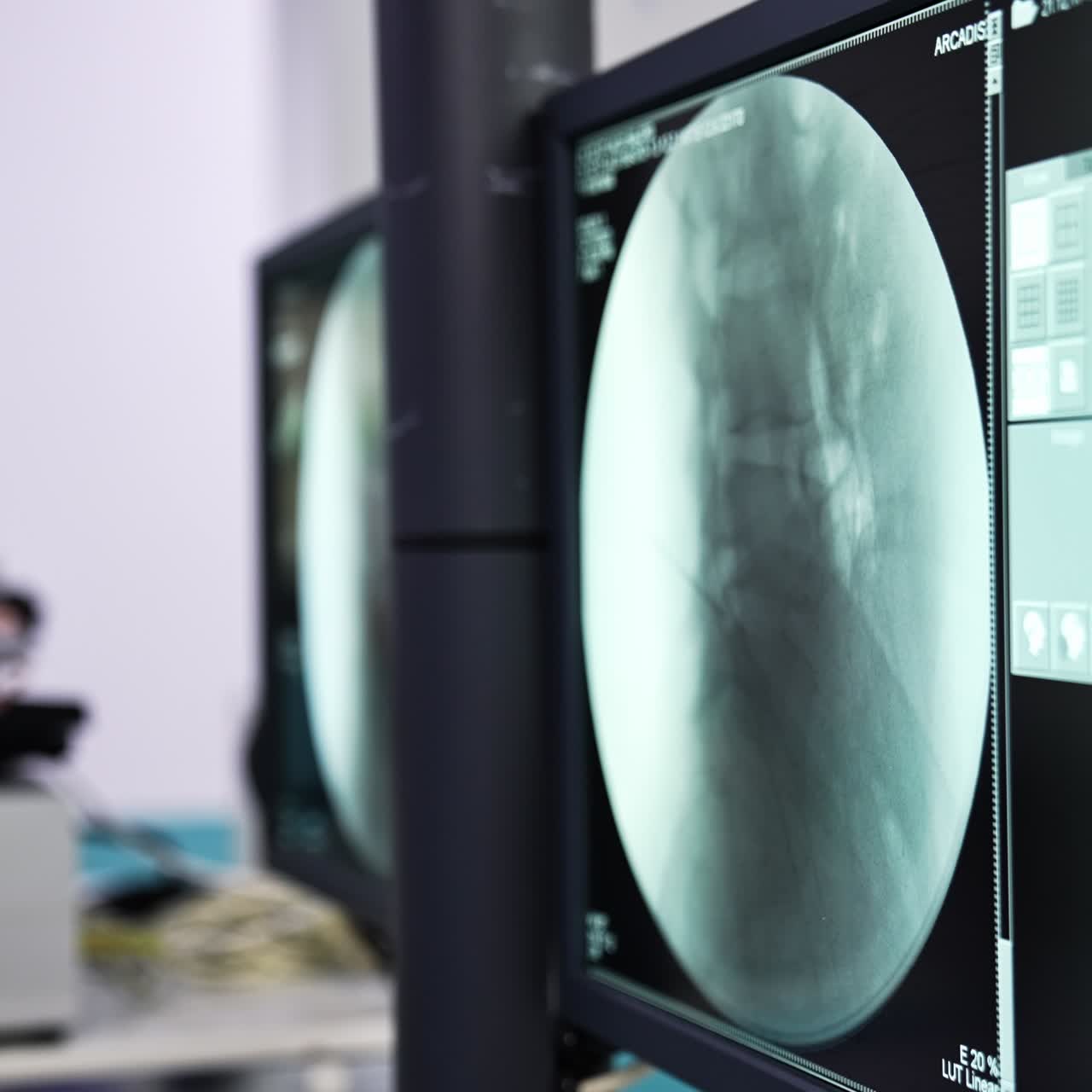 Screen showing the x-ray of spine. Blurred image of a modern surgery room ready for operation. People working in surgery at the backdrop