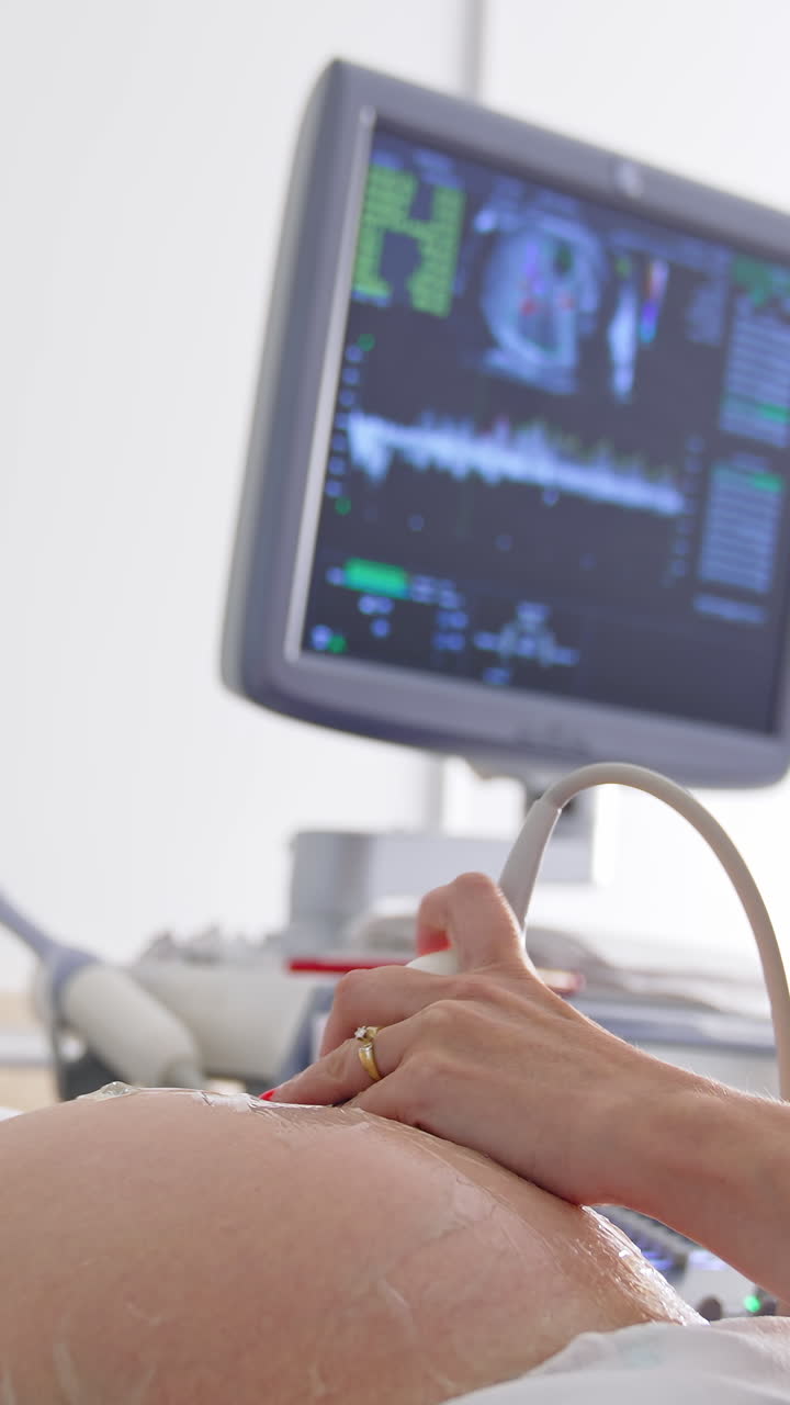 Process of ultrasonography. Young pregnant woman in medical mask doing ultrasonography in modern clinic. Doctor checking future baby in woman belly. Pregnancy during pandemic. Vertical video