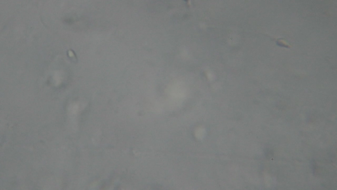 Microscopic view of moving human sperm cells with visible heads and flagella against a light background, commonly used in fertility and reproductive studies