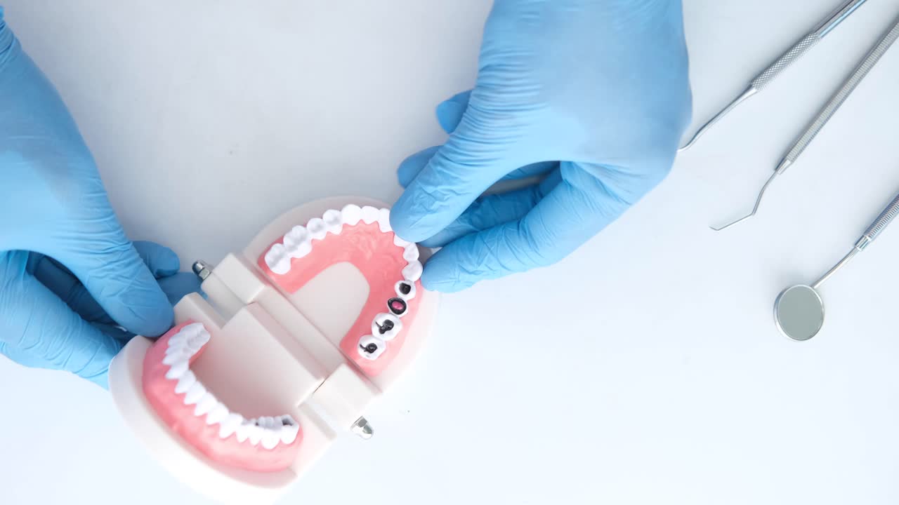 dentista examinando un modelo dental