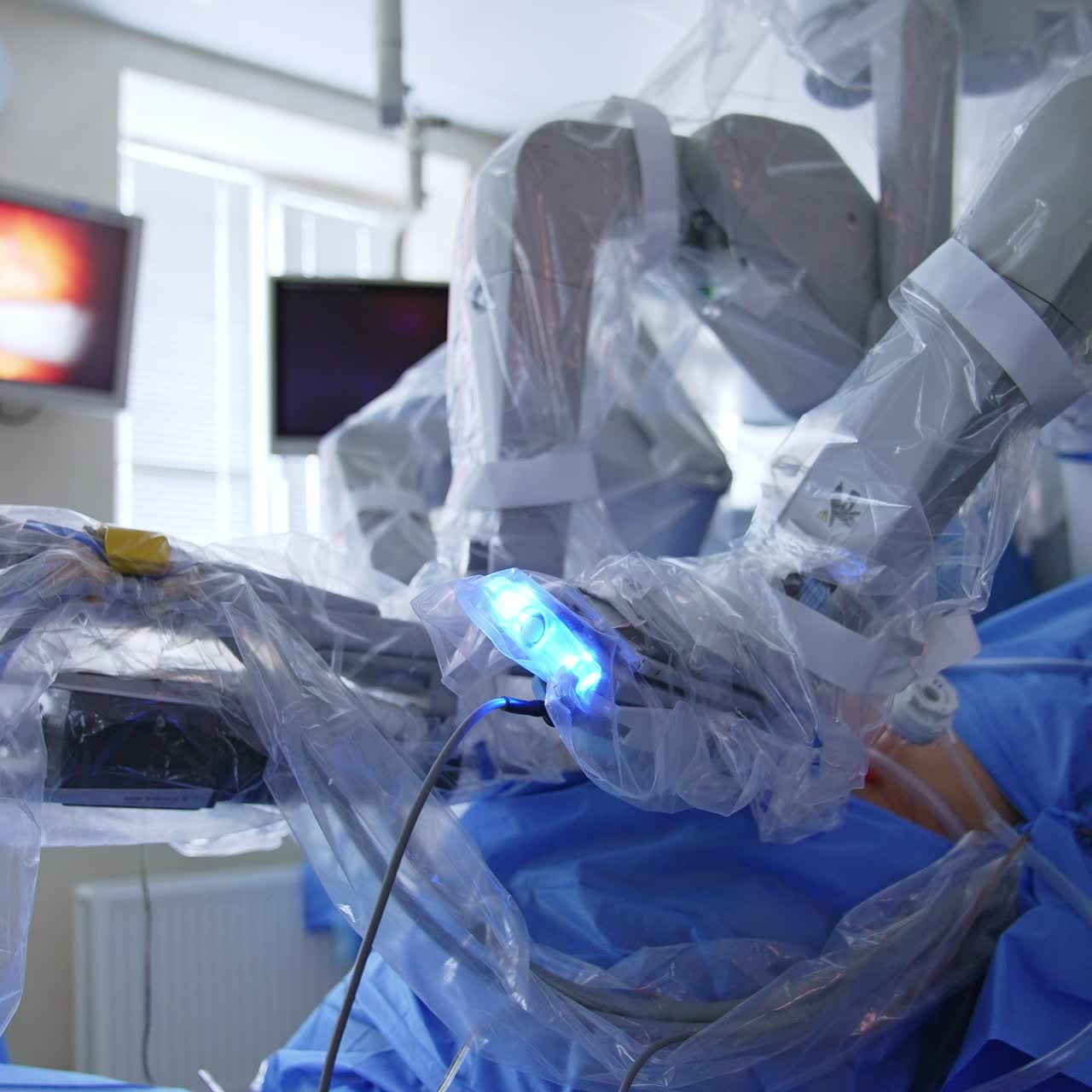 Da Vinci robot performing surgical operation on a patient. Screen on the wall demonstrating precise work of advanced technological equipment