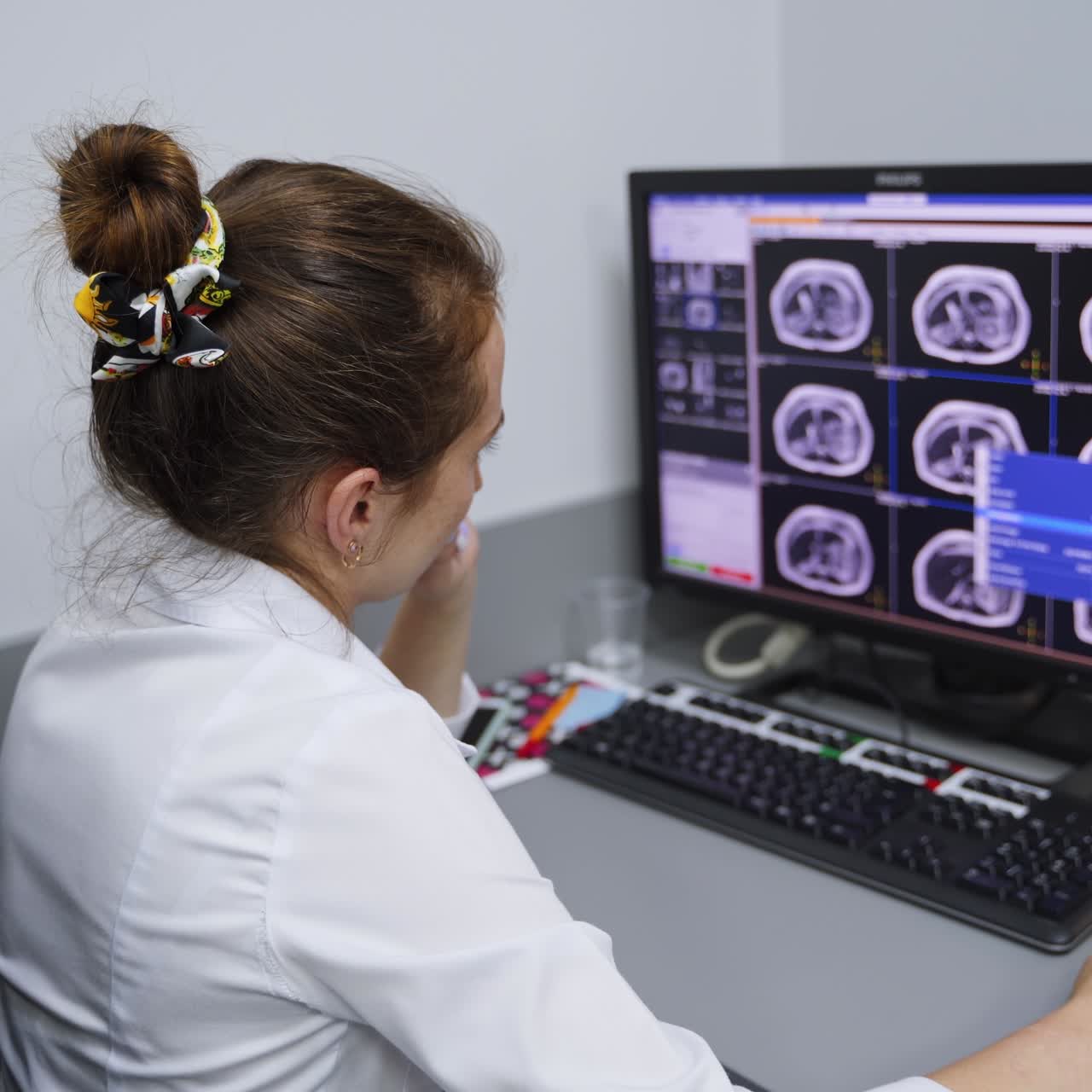Medico seduto alla scrivania davanti al computer che guarda scansioni cerebrali simili. Medico che analizza i risultati della risonanza magnetica
