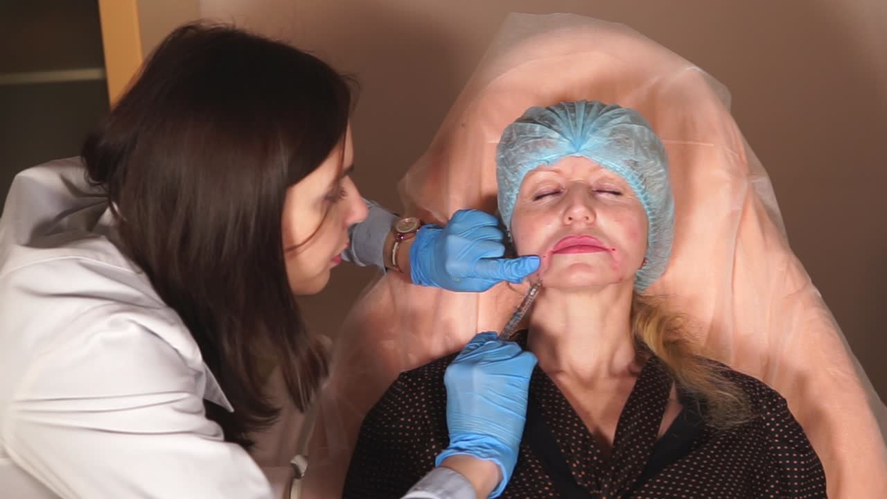 Cosmetic Procedure: Facial Injection