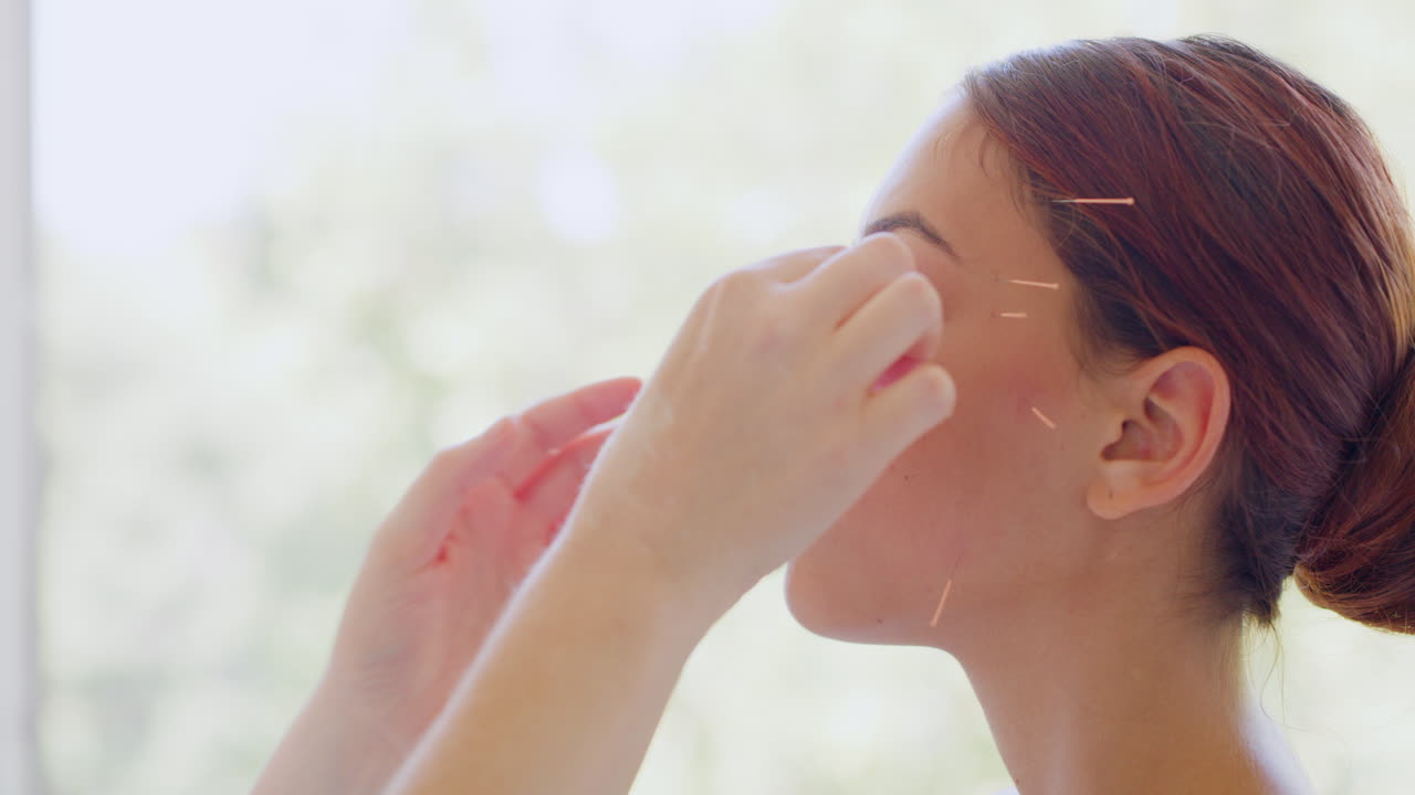 아쿠처 치료를 받고 있는 여성