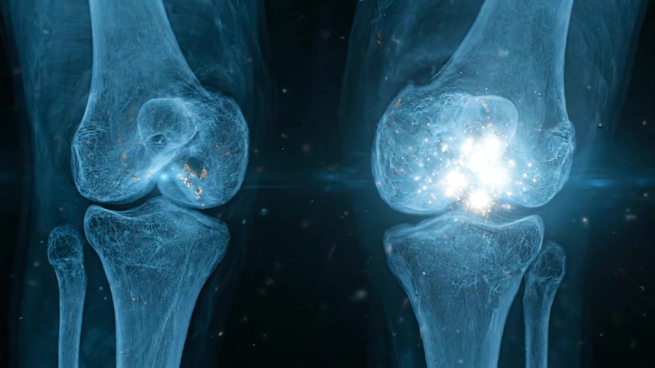 Medical knee joint radiography showing bones and internal structure in detailed scientific footage