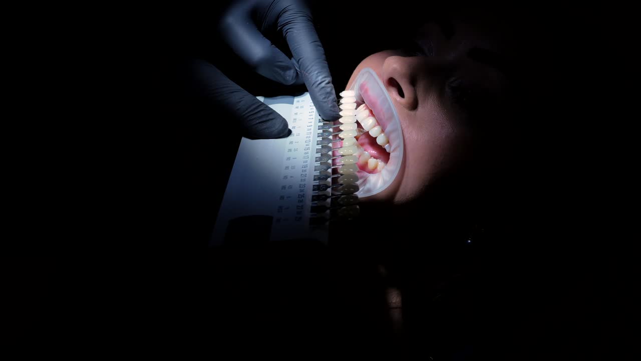 Dental Teeth Whitening Procedure