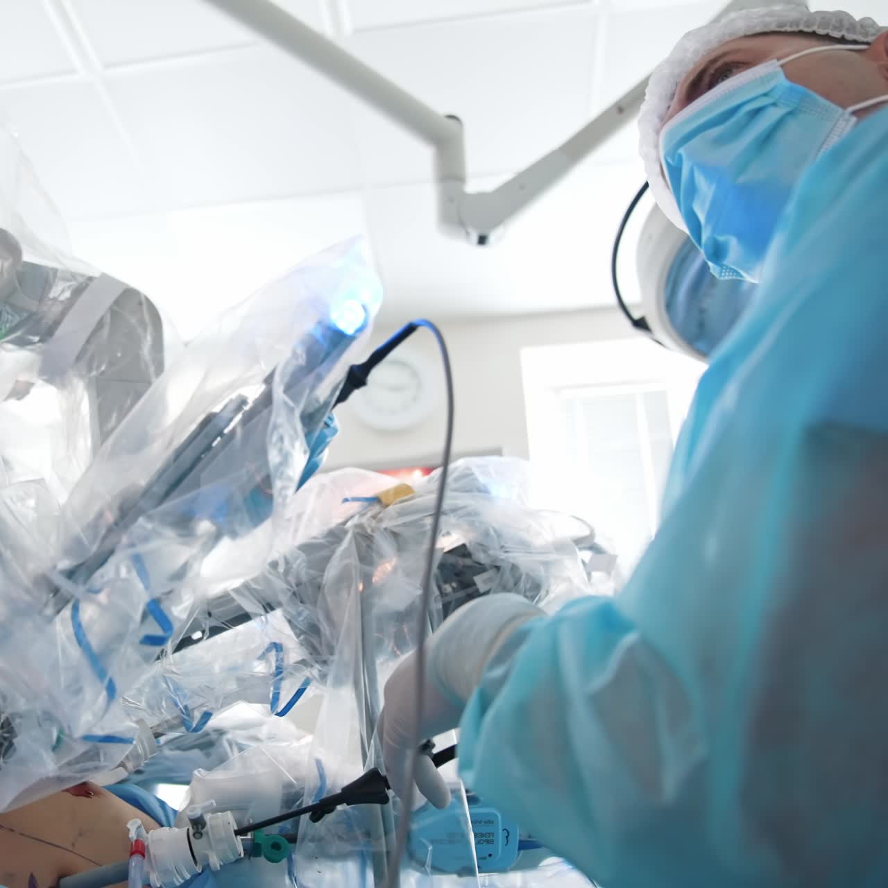 Robotic arms performing surgery to a patient. Modern surgical equipment doing minimally invasive surgery assisted with surgeon. Close-up