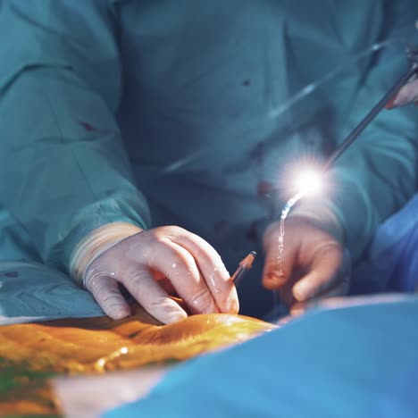 Doctor doing operation