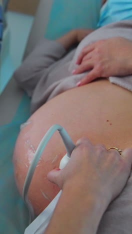 pregnant lady lies on the couch on her side. obstetrician does the ultrasonic diagnostics to a patient at ultrasound equipment. vertical video