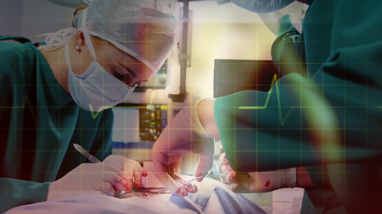 Video verticale: Due chirurghi mascherati che operano in sala operatoria, con bisturi che taglia e ripara sotto una griglia ECG