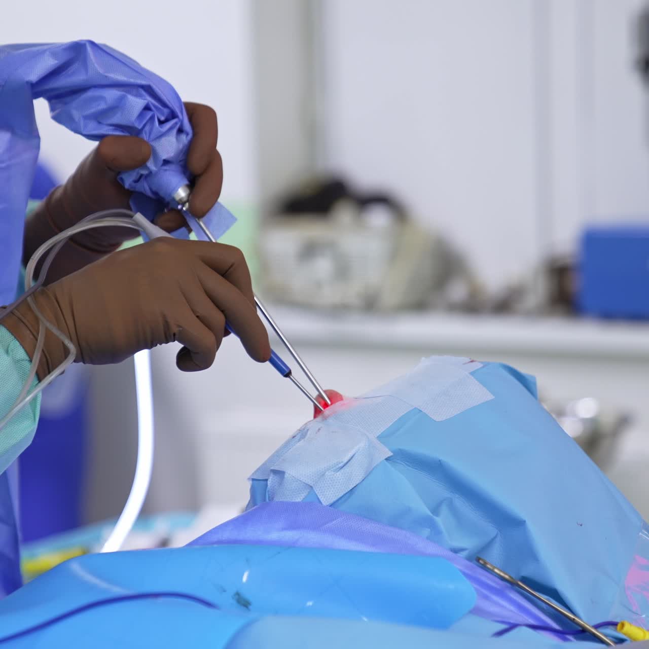 Surgeon's gloved hands input advanced instruments into patient's nose. Nasal operation with usage of modern technologies. Blurred backdrop