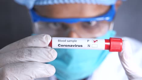 coronavirus blood sample testing