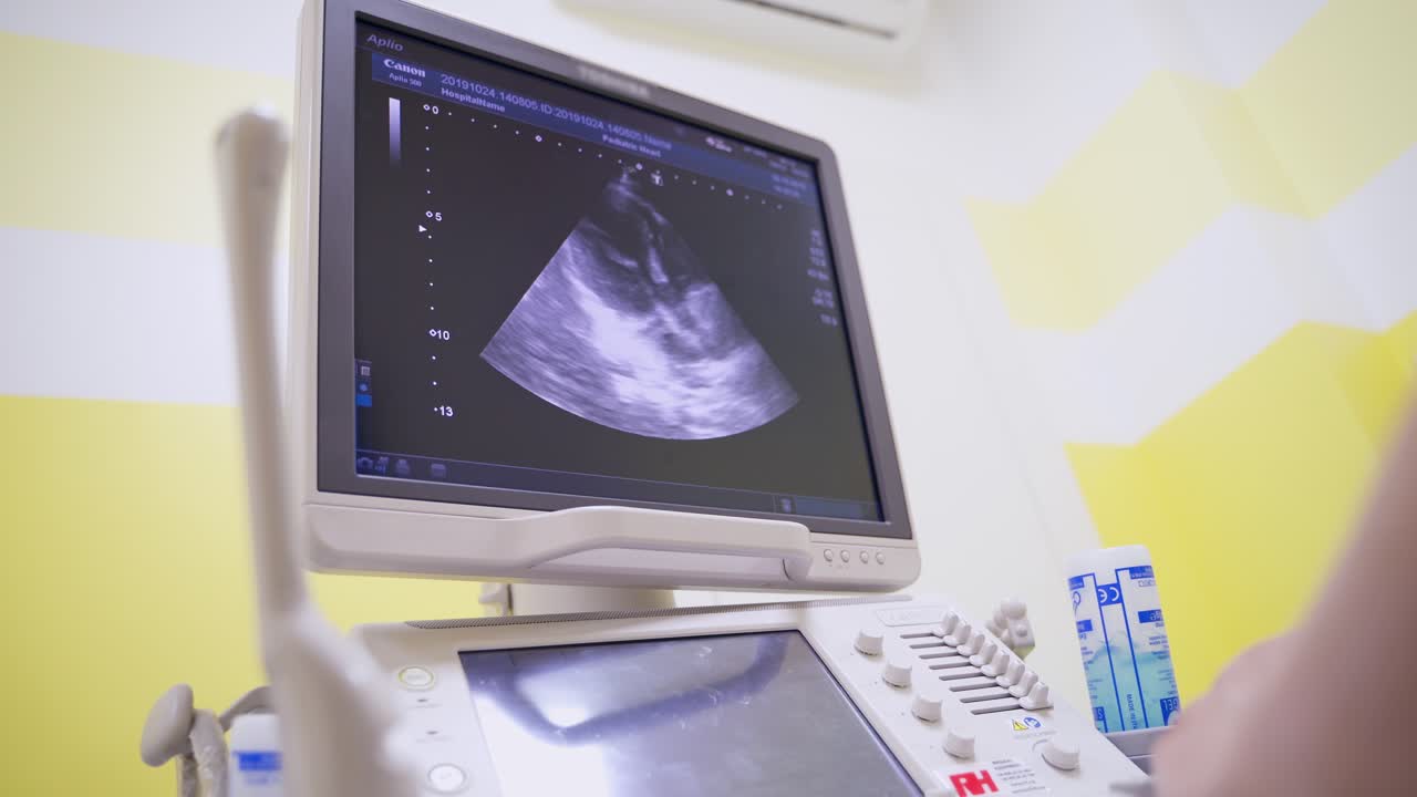 Panning shot of modern ultrasound machine. Screen of ultrasound machine for diagnostics in healthcare at the medical centre.
