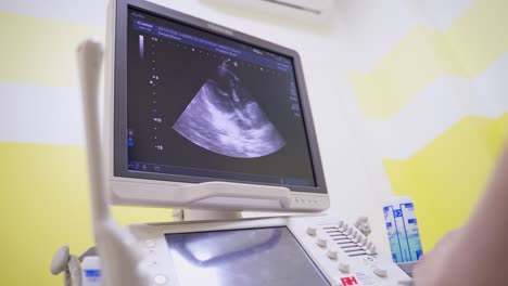 panning shot of modern ultrasound machine. screen of ultrasound machine for diagnostics in healthcare at the medical centre.