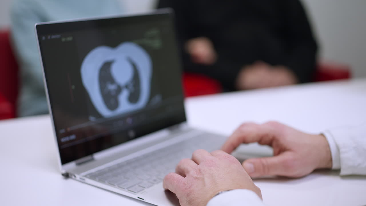 Medical professional examining a CT scan on a laptop