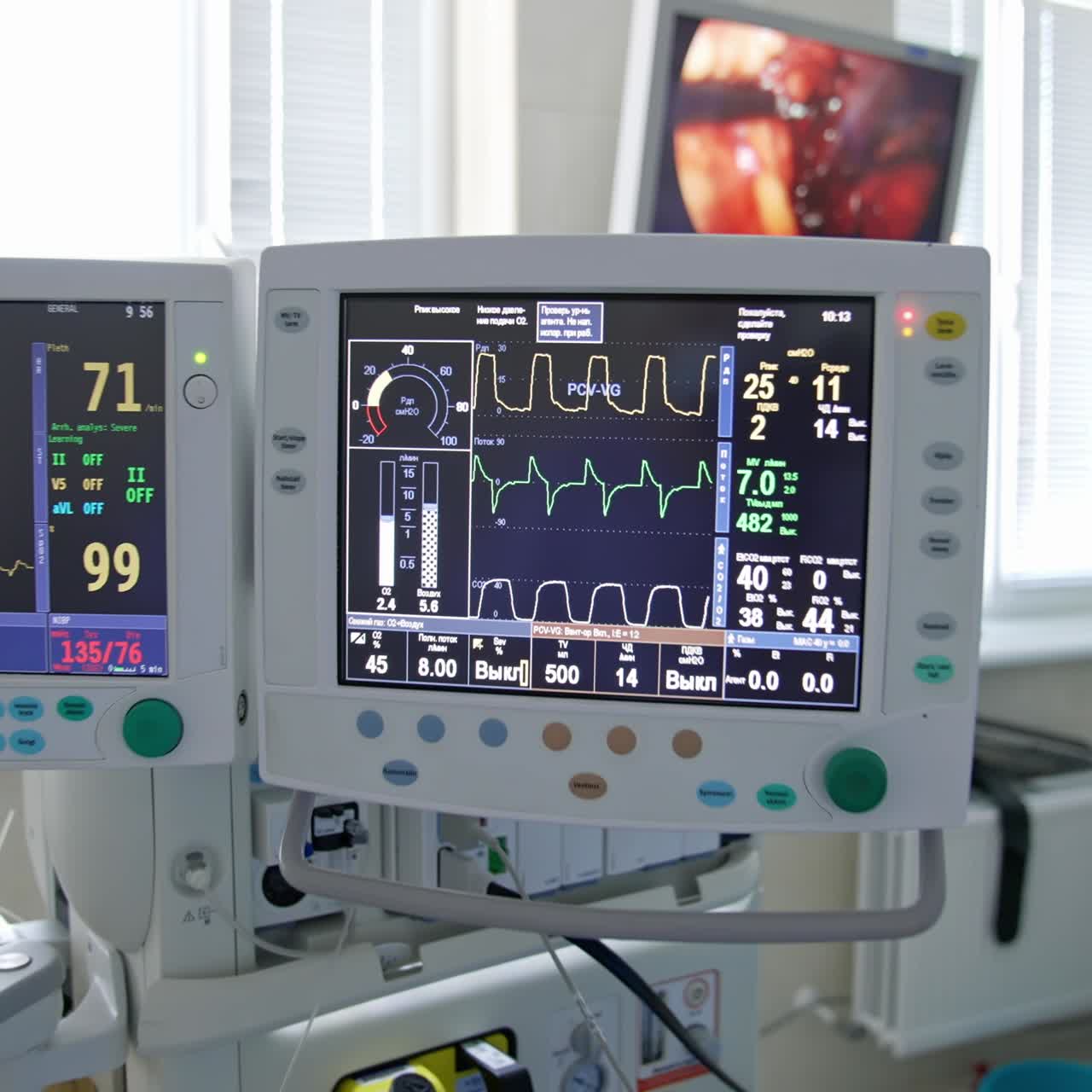 Modern medical operation room with monitor. Graphic lines on the screen of monitor to show heart ecg about the patient's condition during the operation