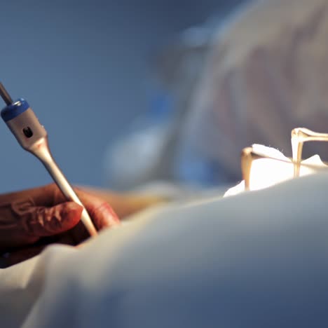 doctor during surgery. doctor concentrating on patient during surgery