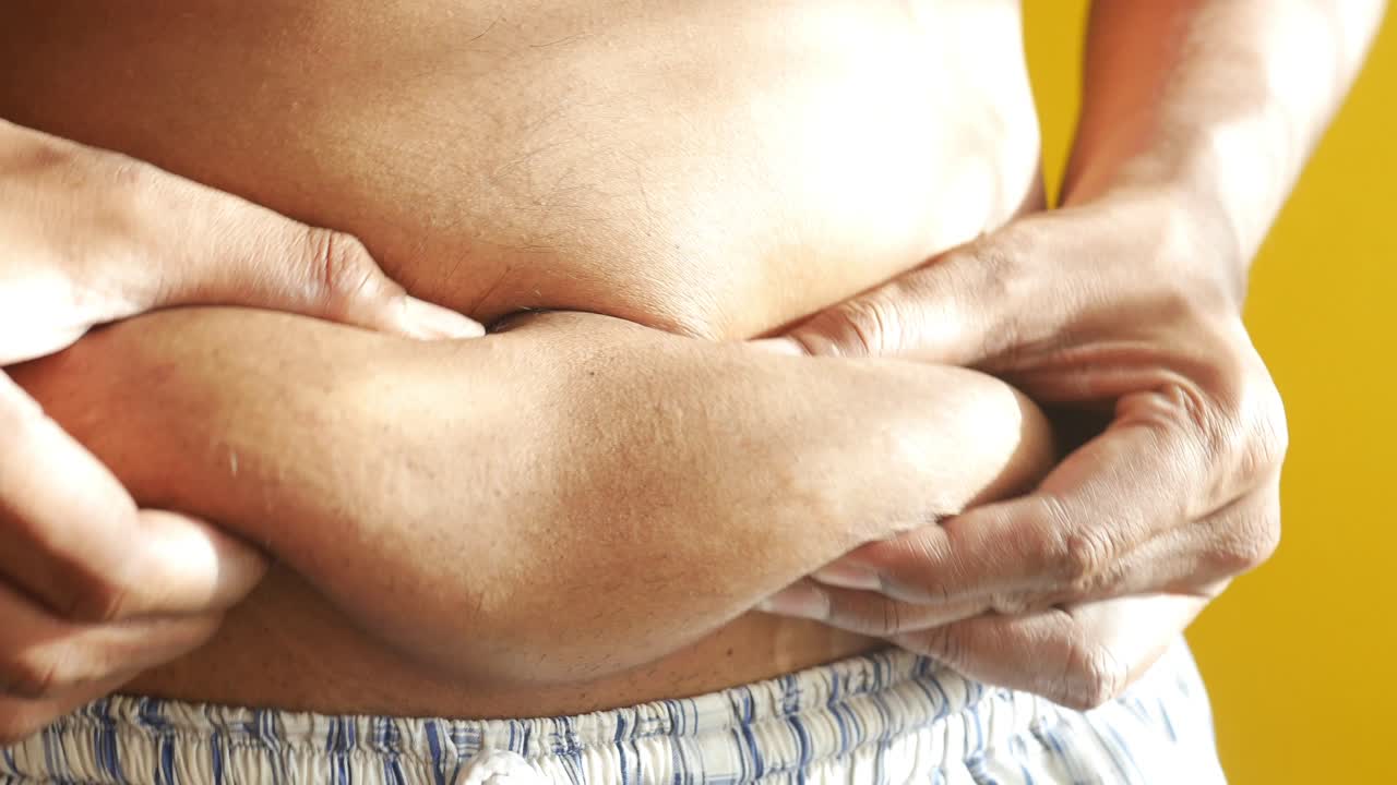hombre con exceso de grasa abdominal