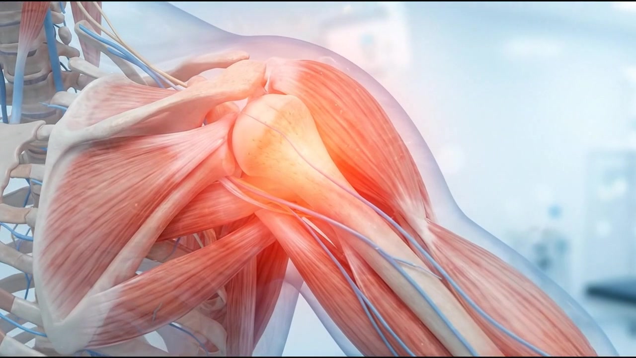 Animazione medica 3D dell'anatomia e del dolore dell'articolazione della spalla umana.