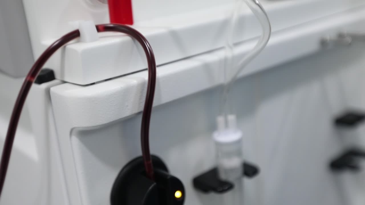 지속적인 신장 대체, covid 19에서 회복된 환자의 기증에서 흐르는 혈장