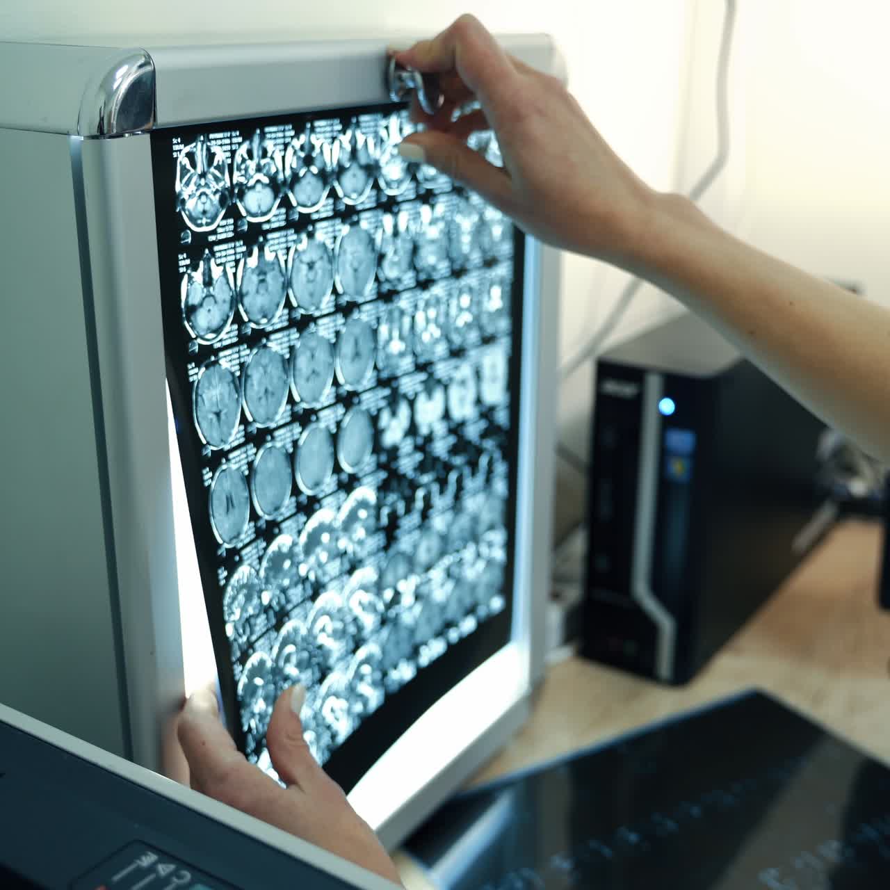 Female hands placing the MRI shot of head on the screen with light. Computer screen with x-ray image at backdrop on the table