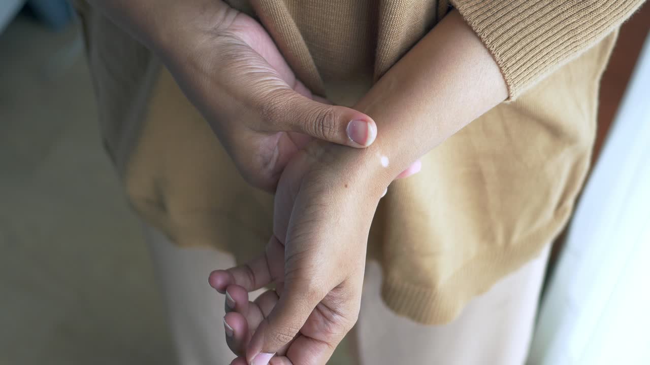 vista de cerca de la muñeca de una mujer con una mancha pálida notable en su piel