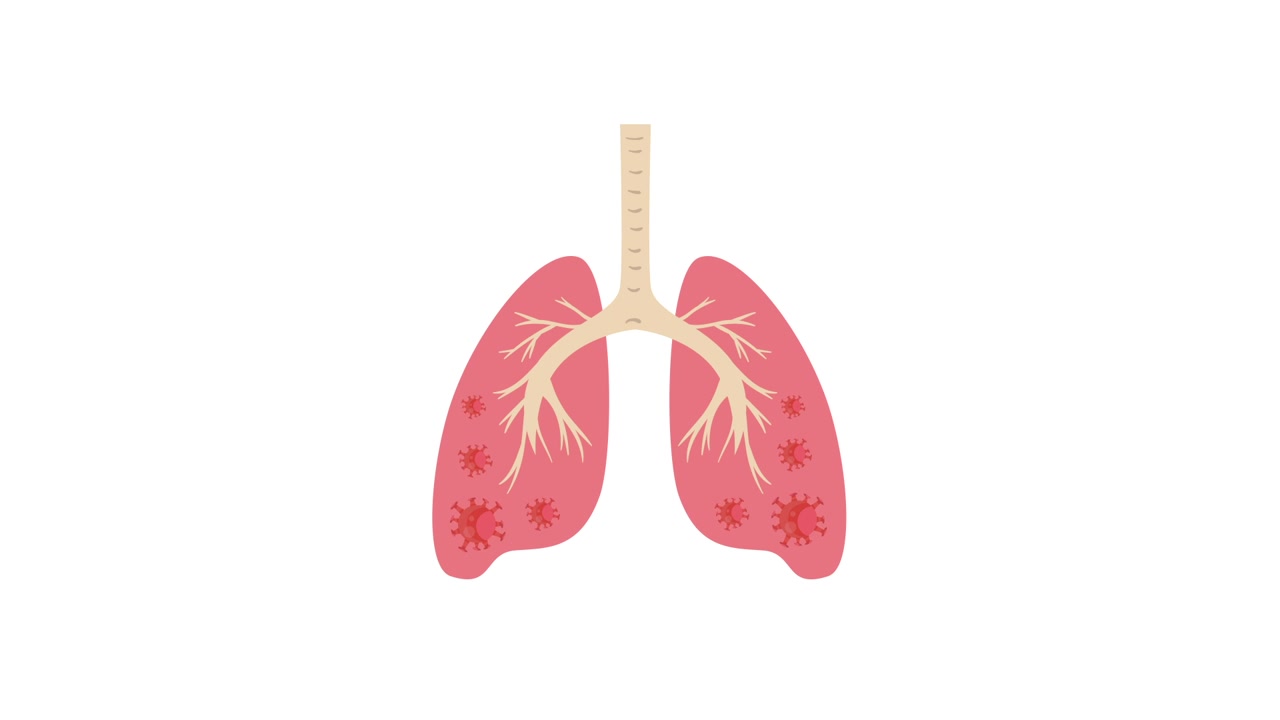 Animazione medica che mostra un'infezione virale nei polmoni