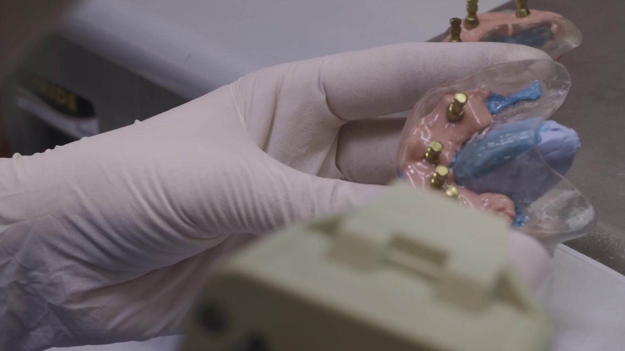 Gloved hand holding a colorful denture mold with metal attachments during creation