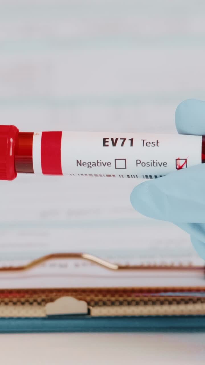 Closeup of doctor proudly presenting positive ev71 blood test results