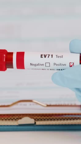 closeup of doctor proudly presenting positive ev71 blood test results