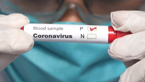 prueba de muestra de sangre de coronavirus