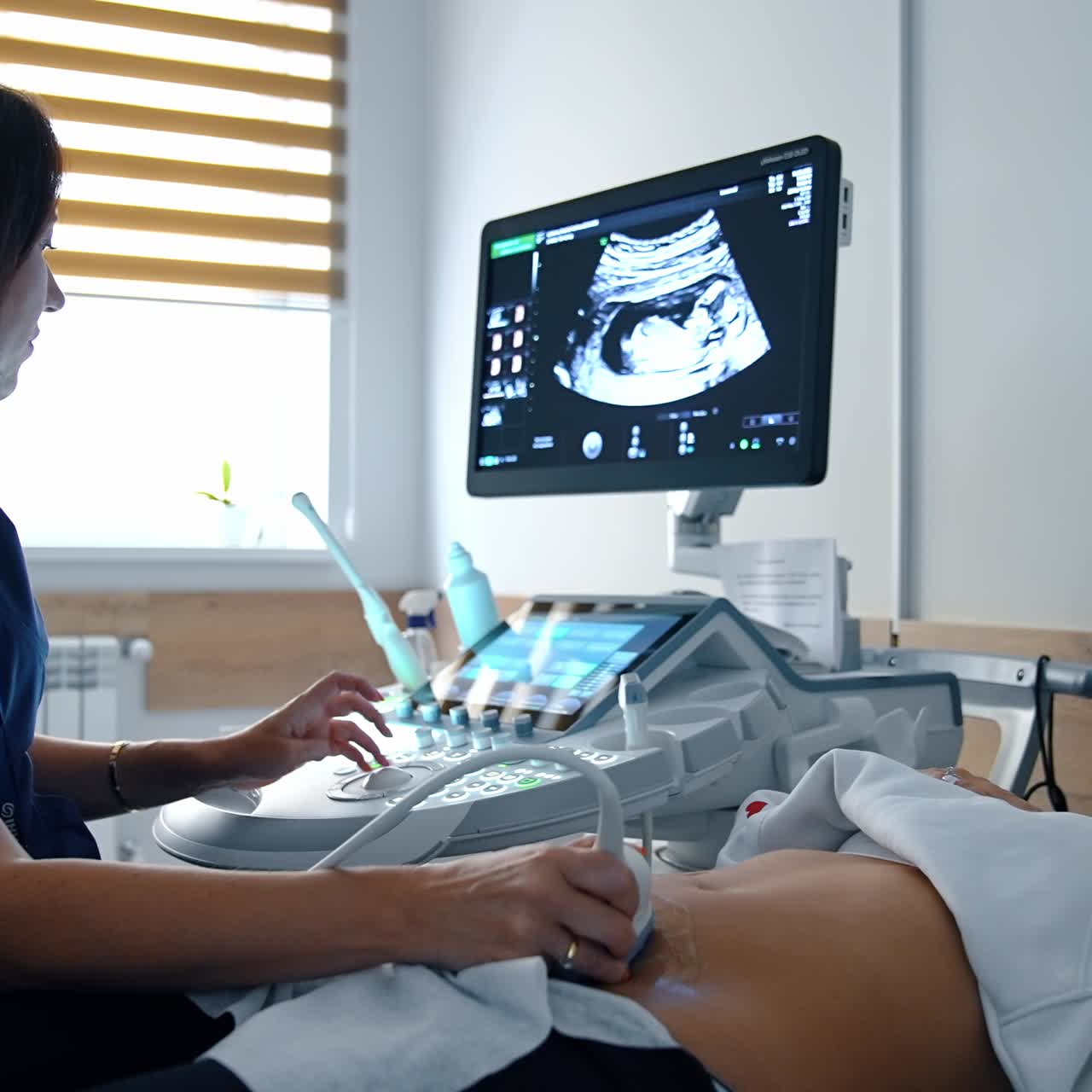 Una dottoressa esegue un esame ecografico a una donna caucasica. La signora incinta sorride mentre vede il suo futuro bambino sullo schermo