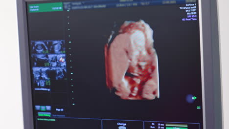 pictures of fetus on the screen of monitor. scientific analysis. ultrasonography of pregnant woman. ultrasound monitor displaying a small baby in pregnant woman's belly.
