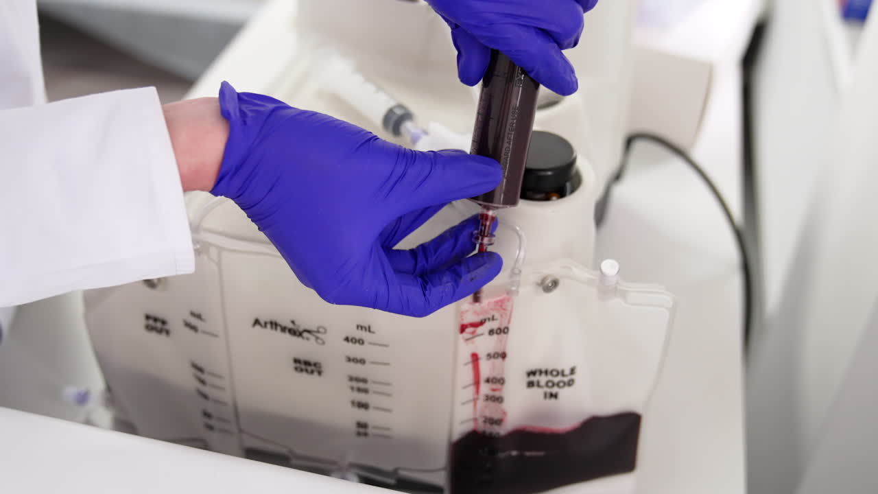 Medic pours blood from a large syringe into a plastic bag. Preparation for the process of plasma extraction. Close up.