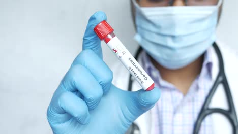 médico con un tubo de ensayo de muestra de sangre para la prueba de coronavirus