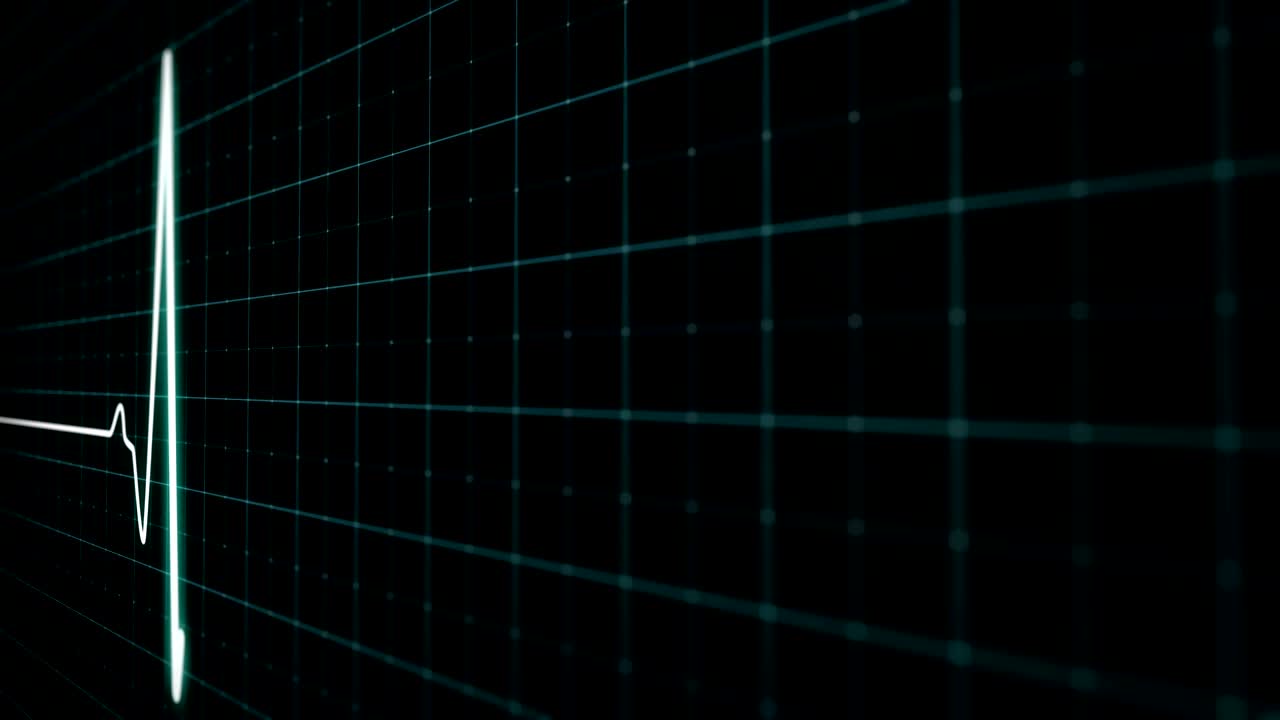 심장마비 또는 갑작스러운 심장마침이 전시되어 있습니다.