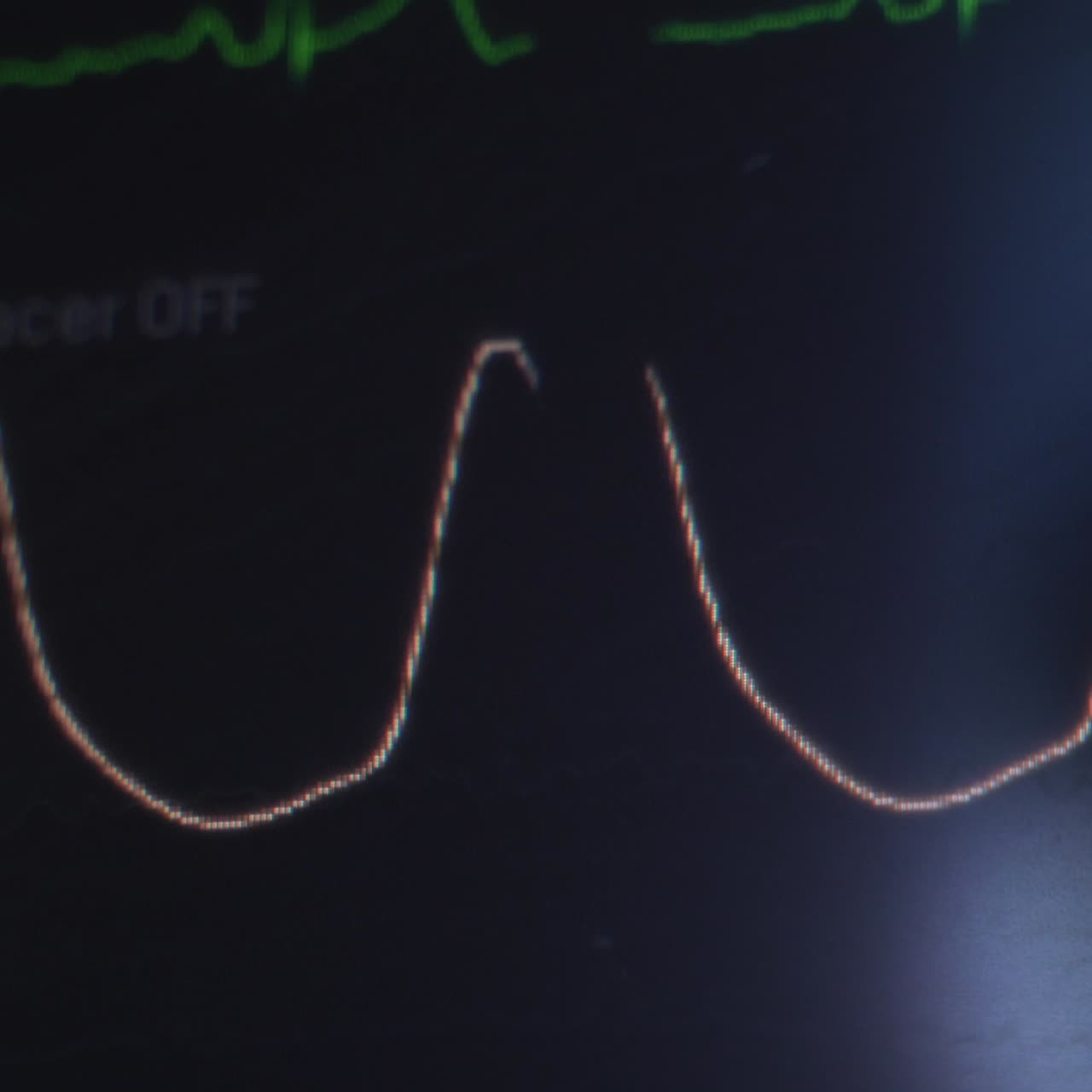 Curve of patient's heartbeat on the medical screen. Monitor displaying vital signs of the patient. Close up