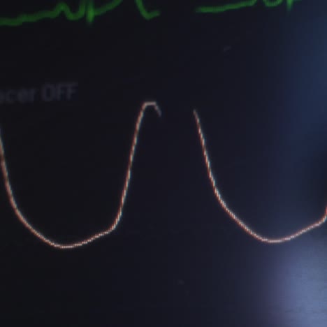 curve of patient's heartbeat on the medical screen. monitor displaying vital signs of the patient. close up