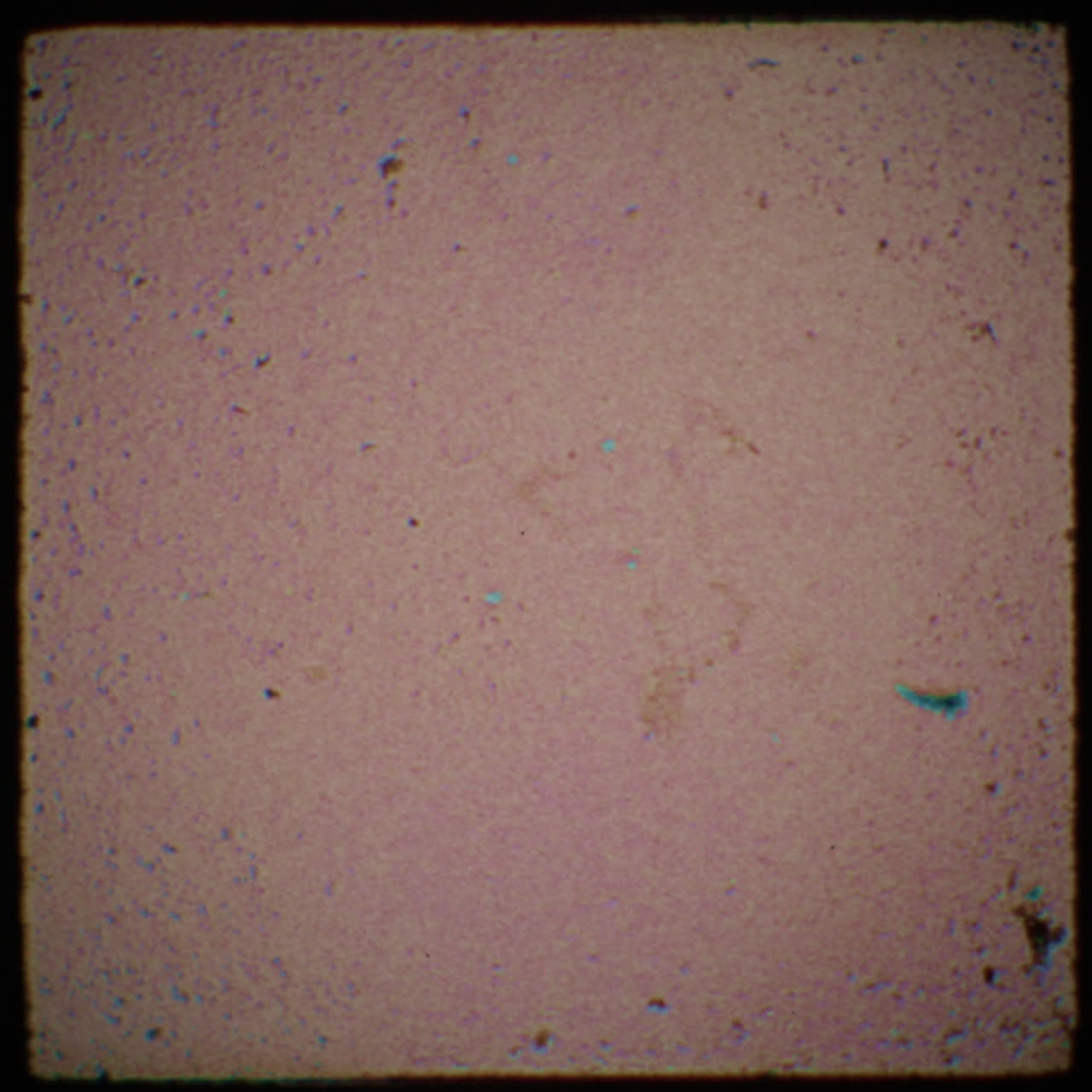 Old Film Frame with Noise and Grain