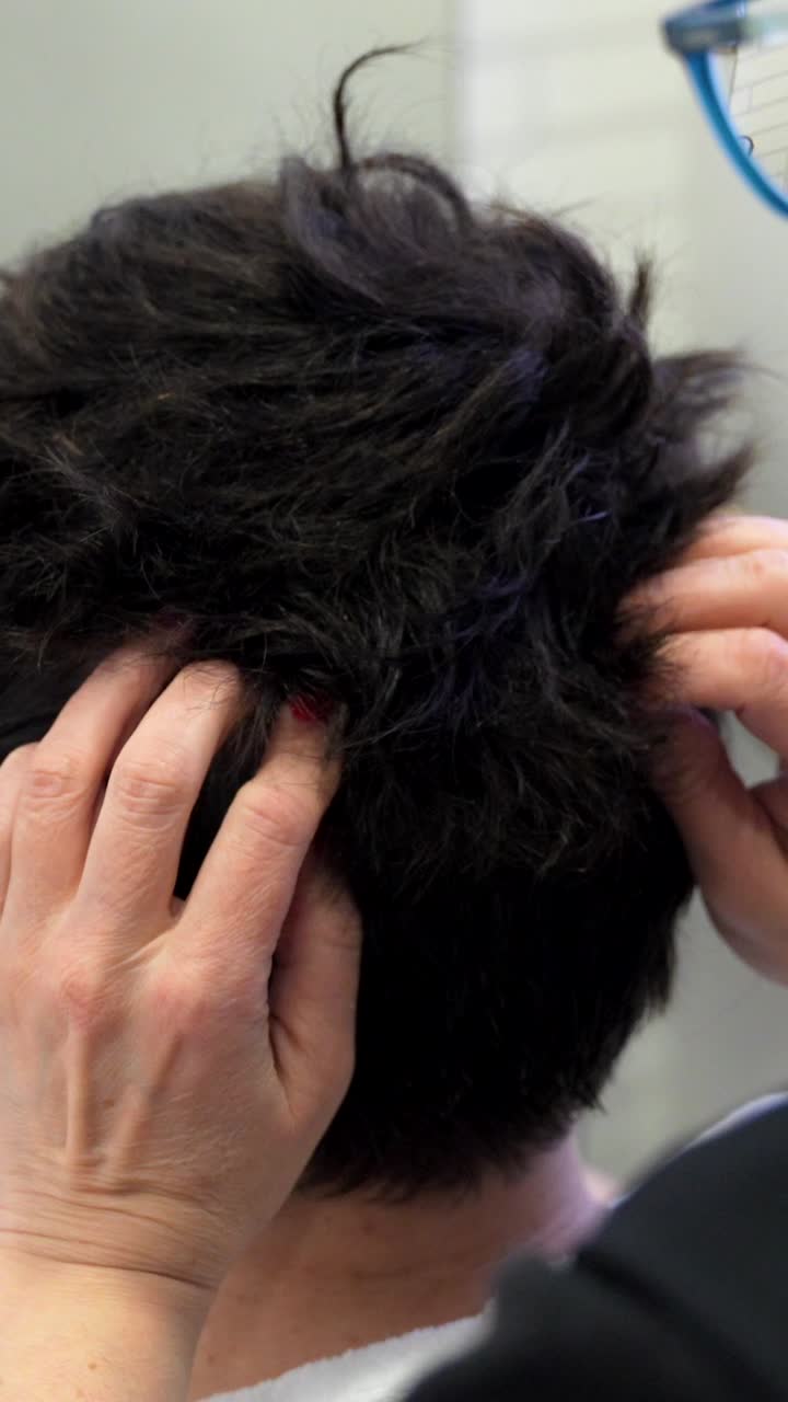 Hair Replacement System Installation