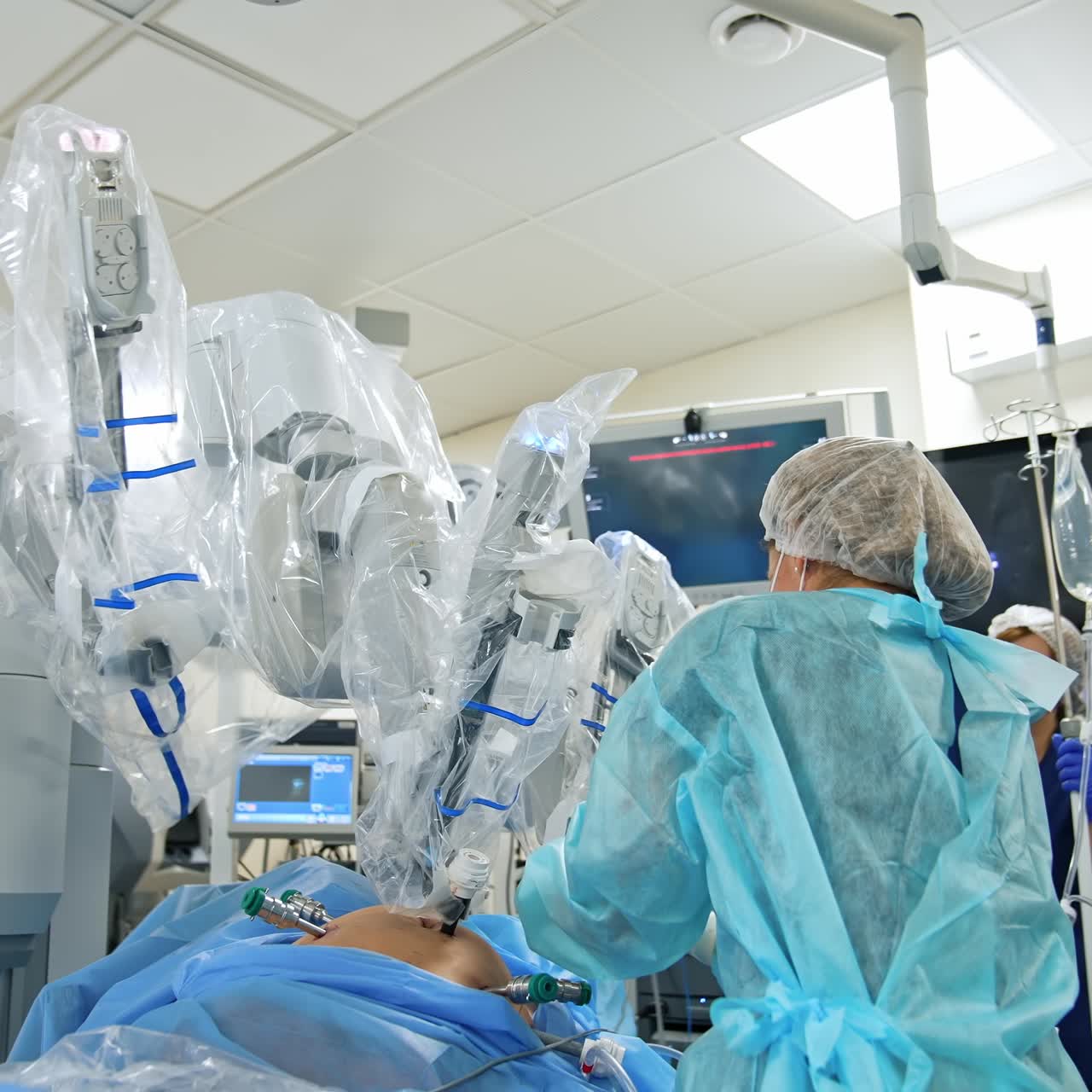 Operation With Da Vinci Robot. Surgical room in hospital with robotic technology equipment
