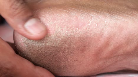 cerca de los jóvenes pies secos aislados en blanco ,