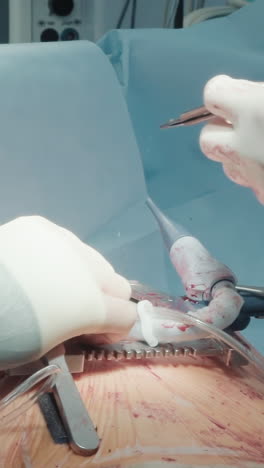 el cirujano toma el hilo con micro pinzas. el médico prepara las herramientas necesarias para el injerto de vasos en las arterias coronarias. la enfermera sostiene strippers de venas