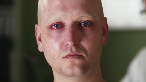 Man with Cancer