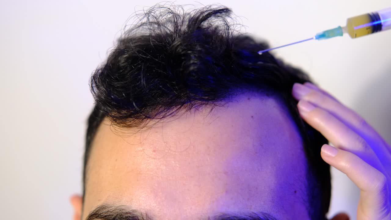 머리카락 관리 주사