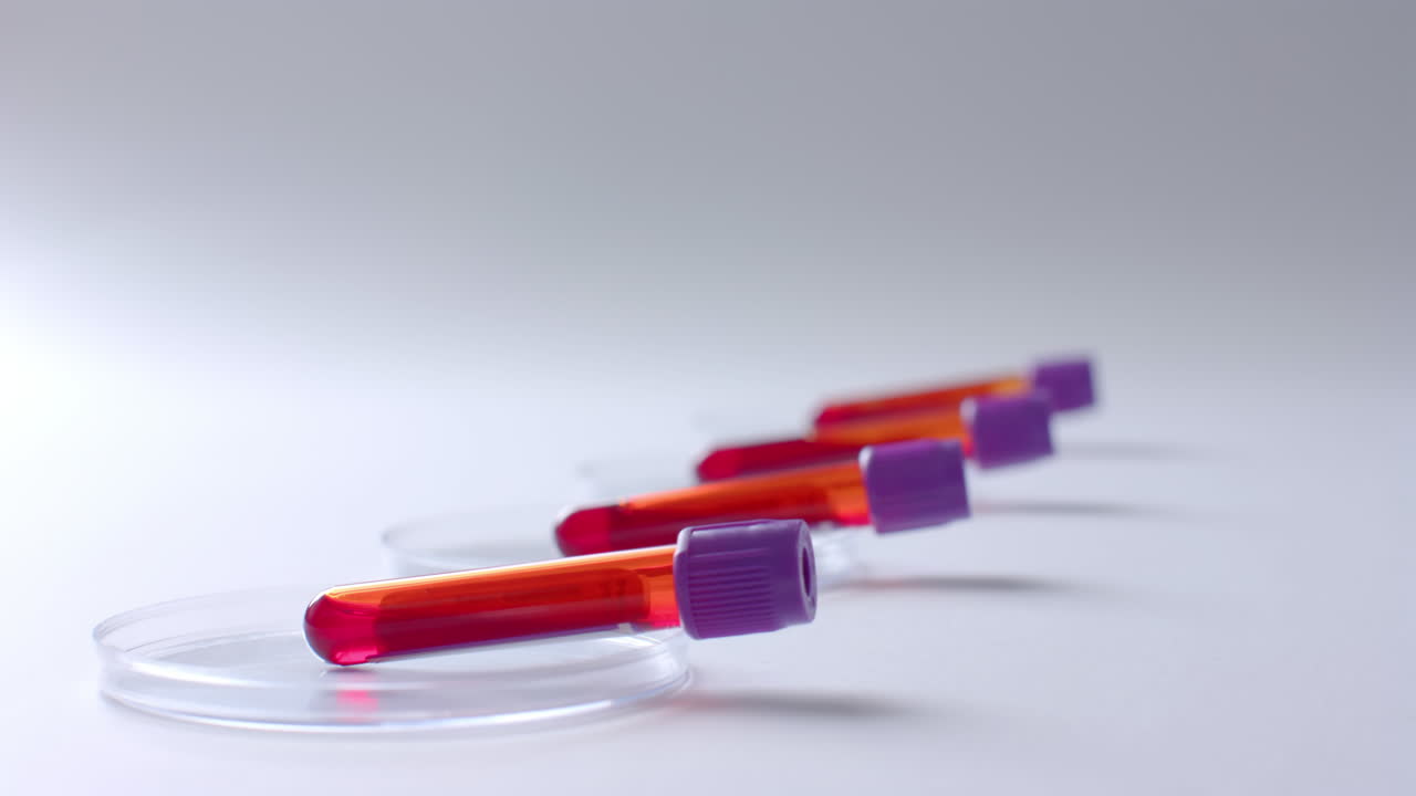 백색 배경에 있는 혈액  ⁇ 플과 페트리 접시의 클로즈업, 복사 공간, 슬로우 모션