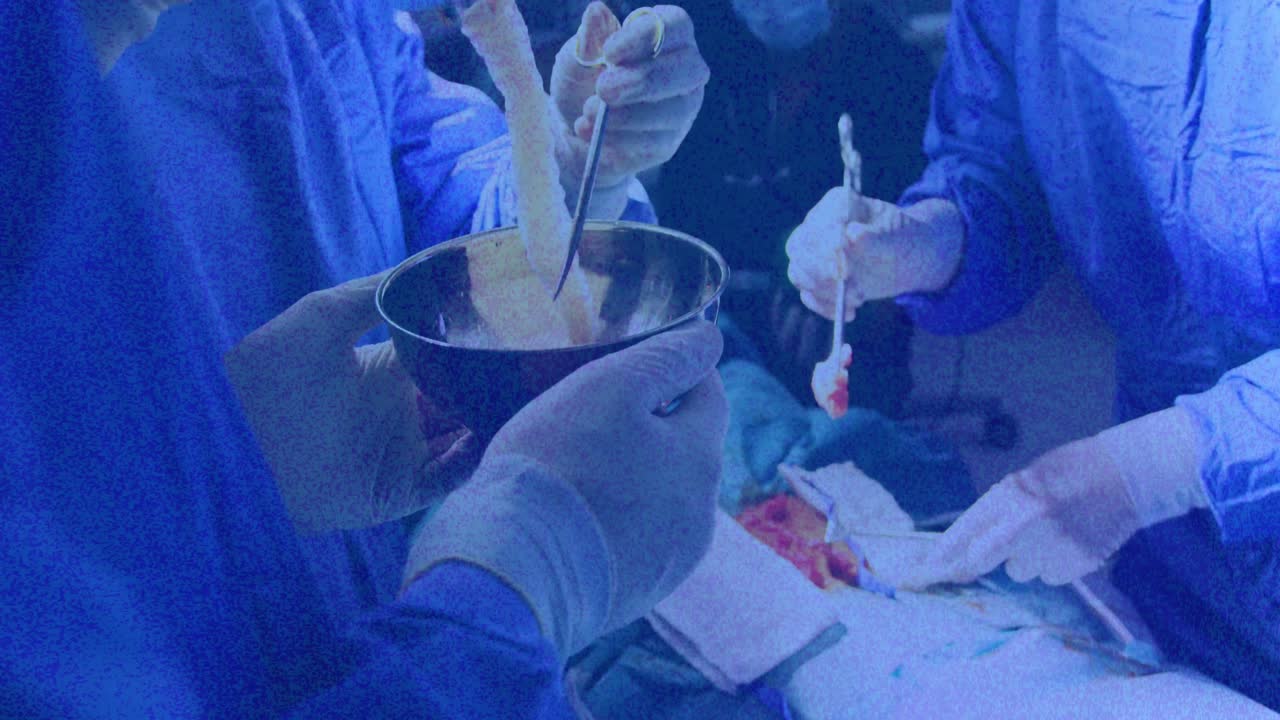 의료진이 수술을 합니다.